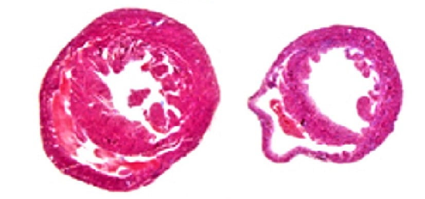 atrophy-THUMB-2.jpg Cardiac Atrophy Findings May Set Course for Preventing Harm from Long Space Flights