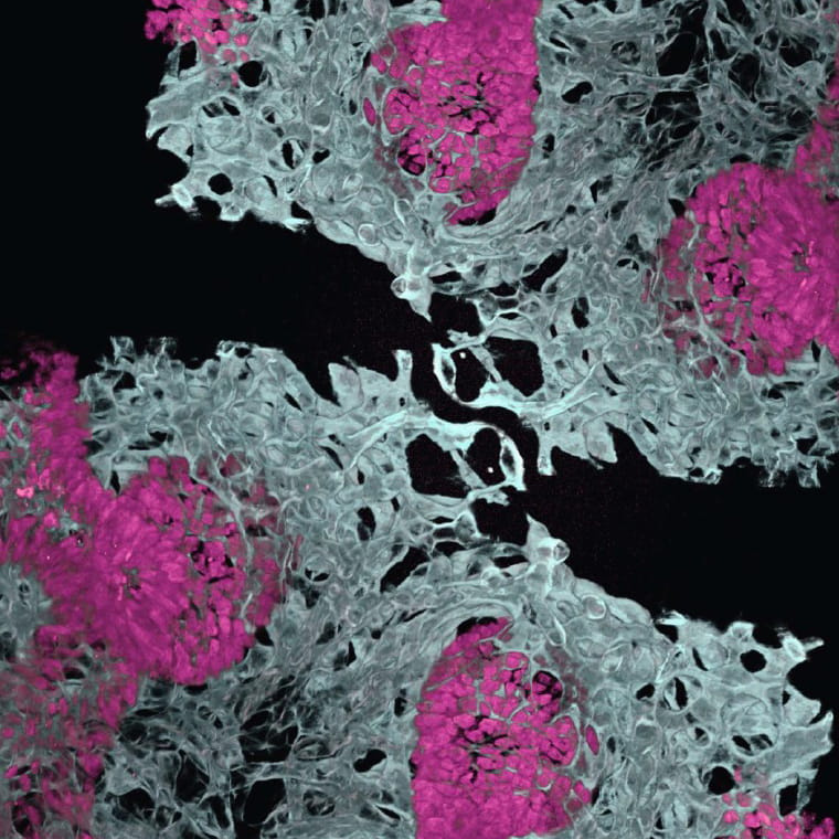 lung organoid