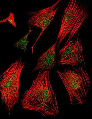 The laboratory is interested in understanding how fibroblasts convert into myofibroblasts during disease stimulation to help mediate tissue remodeling.