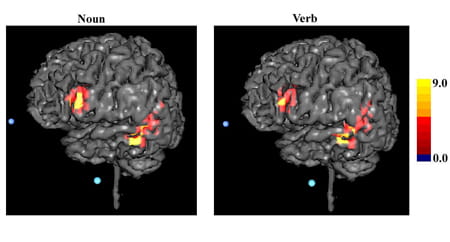 Three-dimensional MR images: noun versus verb.