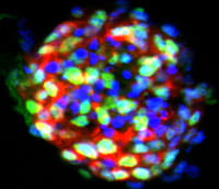 Brain tumor stem-like cells expressing stem cell markers.