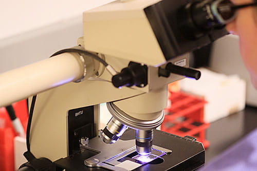 The Diagnostic Center for Heritable Immunodeficiencies (DCHI) at Cincinnati Children’s is the largest and most specialized center in North America for the diagnosis of rare primary immunodeficiencies, bone marrow failure syndromes and other disorders of the immune system.