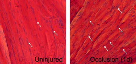 Ischemia causes skeletal muscle atrophy and tissue degradation.