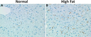 Immunohistochemistry of F4/80 macrophage stain of liver sections of normal (A) and high fat (B) chow-fed mice demonstrating hepatic macrophage accumulation. 10x magnification.