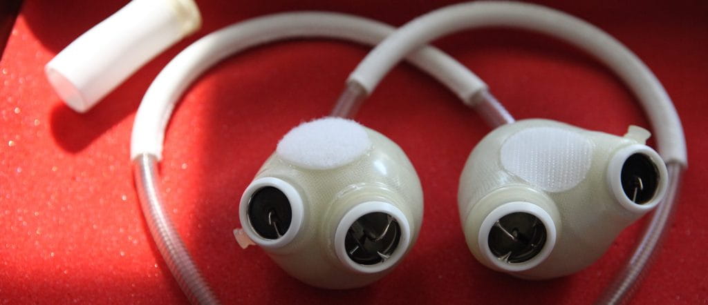 Heart Assist Devices Making a Difference