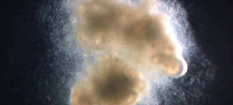 Scientists Add Nerves to Intestinal Organoids