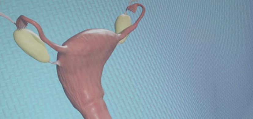 Ovarian tissue cryopreservation