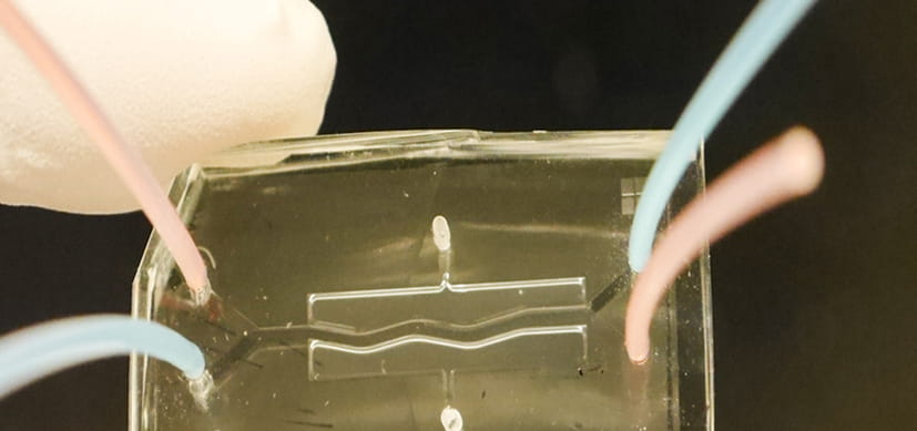 Pancreas-On-A-Chip May Advance Cystic Fibrosis Research