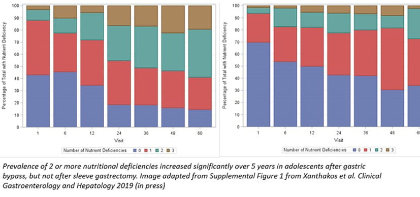 Many Teens Have Low Iron, B12 Levels Years After Bariatric Surgery