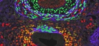 Revealing the Molecular Secrets of Trachea-Esophageal Birth Defects