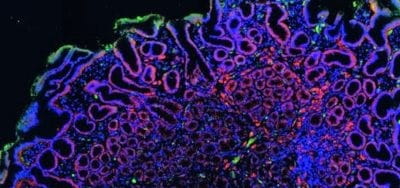 peanut-allergy-8x4-1.jpg Scientists Discover a Peanut Allergy ‘Fingerprint’ That May Help Push Emerging Treatment to New Levels