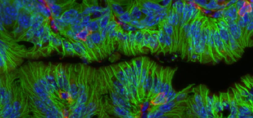 Tissue Healing in the Gut Depends on Help from Friendly Bacteria