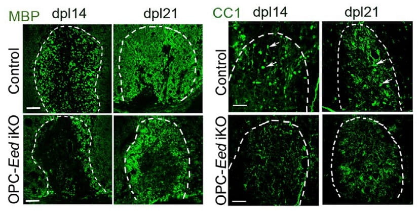 Discovery about nerve fiber insulation may lead to better treatments for several rare conditions