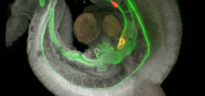 Two Discoveries Boost Next-Generation Organoid Development