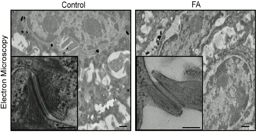 Scientists Regenerate 3D Skin to Study Cancer-Causing DNA Defects in Kids