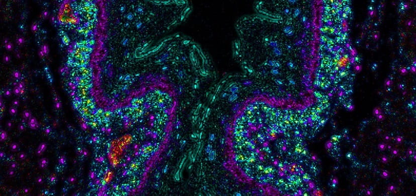 KLK5-image-8x4-1.jpg FDA-Approved Drug Reverses Inflammation in Animal Model of Eosinophilic Esophagitis