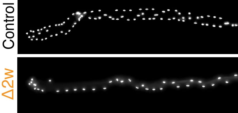 Muscle Growth Can Be Pumped Only So Far