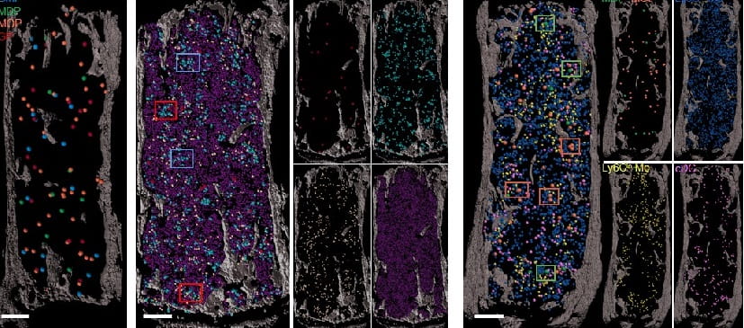Marrow-1-THUMB.jpg Bone Marrow ‘Map’ Opens Path to Organoid-like Blood Stem Cell Production