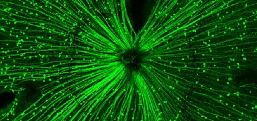 Can This Discovery Prevent the Need for Eyeglasses Someday?