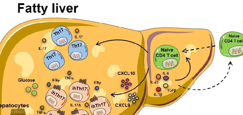 Obesity-NAFLD-3-THUMB.jpg Research Reveals Potential Treatment to Prevent Obesity-Driven Liver Damage