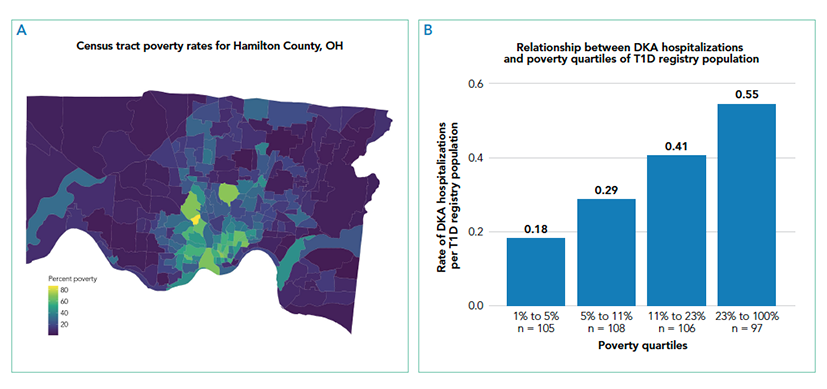 Neighborhood Poverty, Public Insurance Status Outweigh Race for Risk of Diabetes-Related Hospitalization