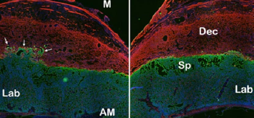 Study Decodes Critical Cell Signals Needed for Successful Pregnancy