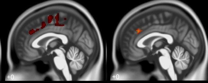 Long-Term Study Documents Link Between Adult Crime and Brain Damage from Childhood Lead Exposure