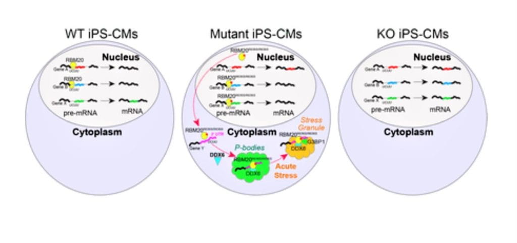 RBM20-THUMB-2-1024x481.jpg Heart Tissue in a Dish Reveals New Links Between Neurodegeneration and Heart Disease