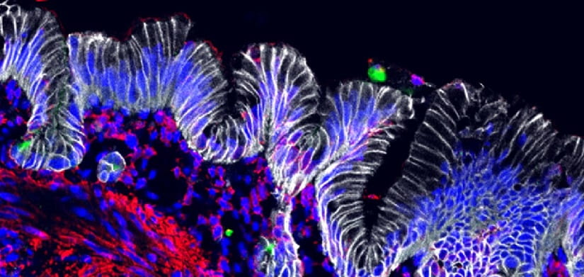 New Assembly Approach Generates Most Complex Stomach Organoids to Date