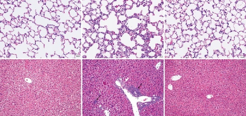 Potential Approach Emerges to Treat Autoimmunity and Prevent Serious Side Effects of Cancer Immune Therapies