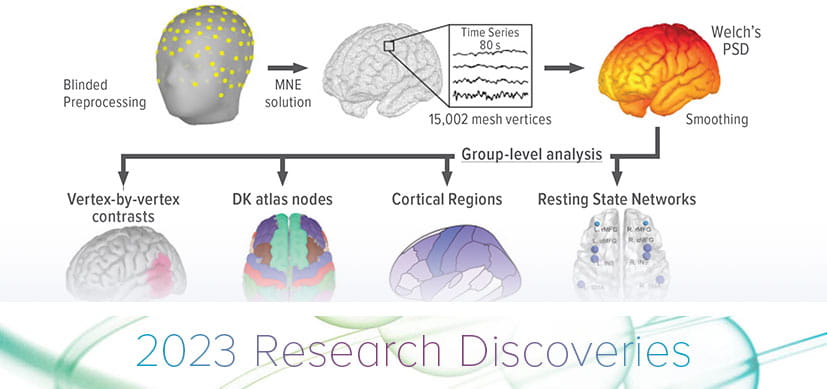 Exploring How Thalamocortical Modulation Impacts Brain Function in Fragile X Syndrome