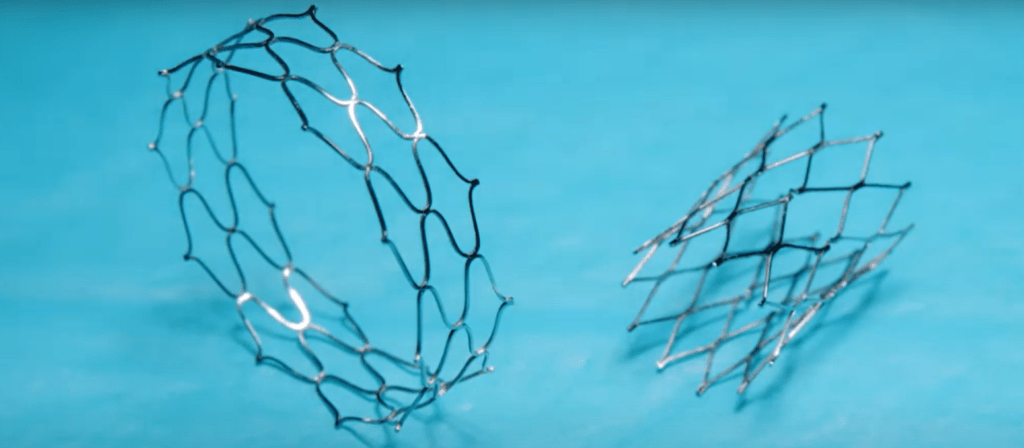 Novel Cardiac Stent Designed to be Expanded as Young Patients’ Arteries Grow