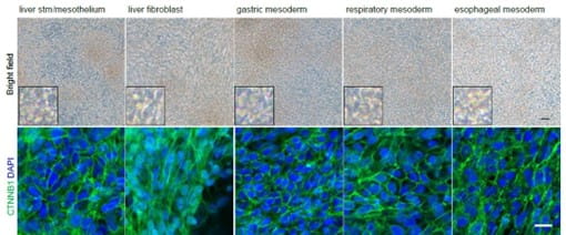 U.S.-Japan Science Team Publishes New Recipe for Creating Complex Organoids