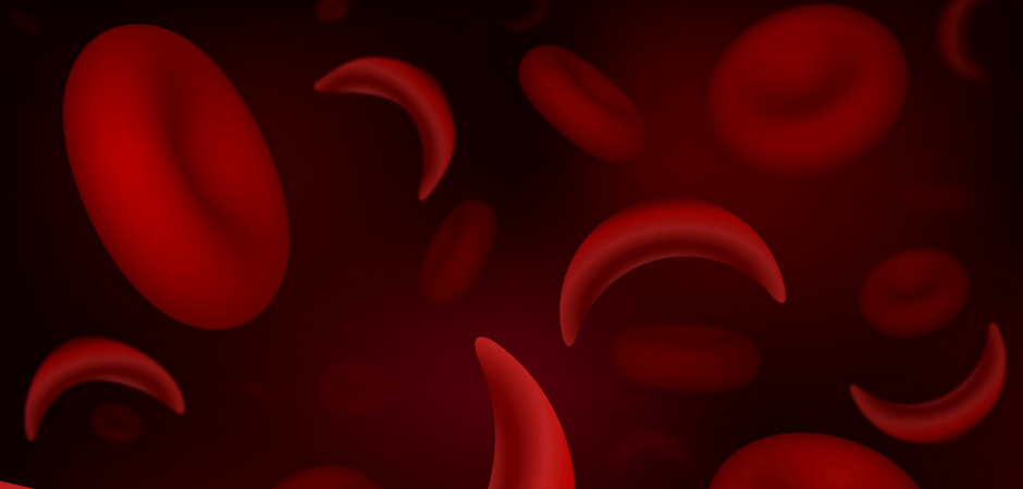 Hydroxyurea Research Gets $7.7M Boost from NHLBI