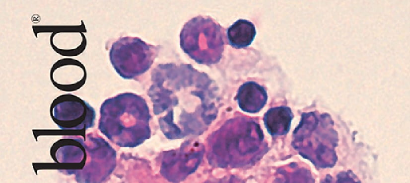 Blood Cell Production Discovery Opens Path to Improve Anemia of Inflammation