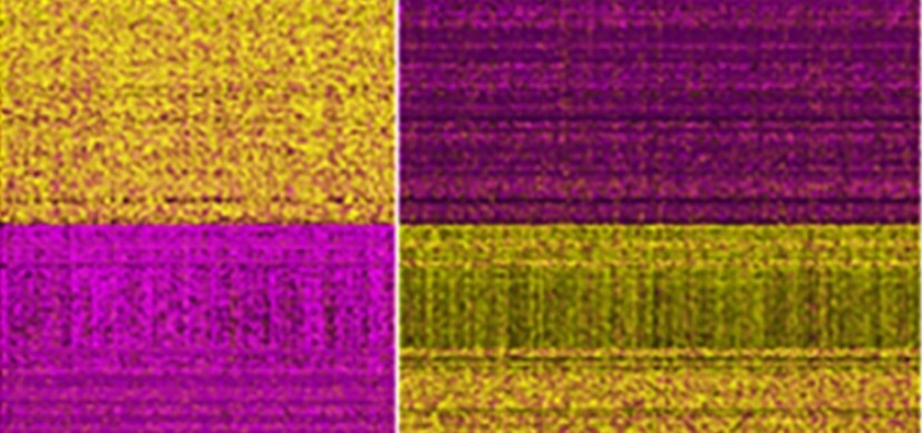 Fig3f-blog-THUMB.jpg Single-Cell ‘Atlas’ Reveals Origin of an Aggressive Brain Tumor