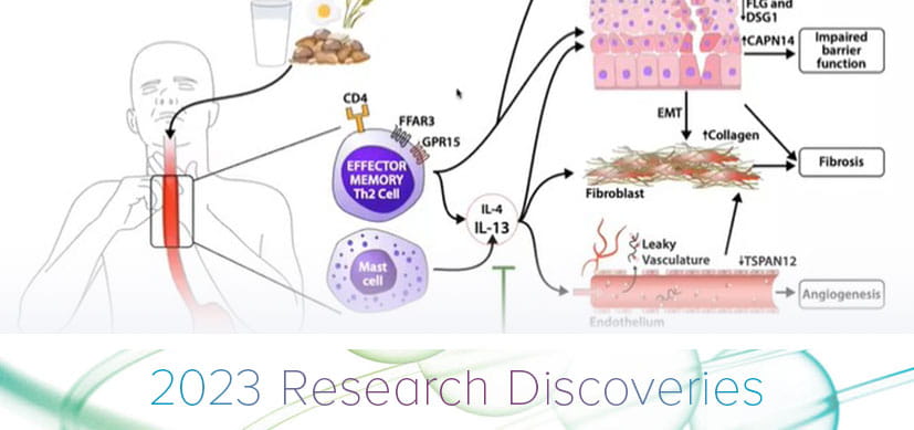 Biological Agent Successfully Treats Eosinophilic Esophagitis