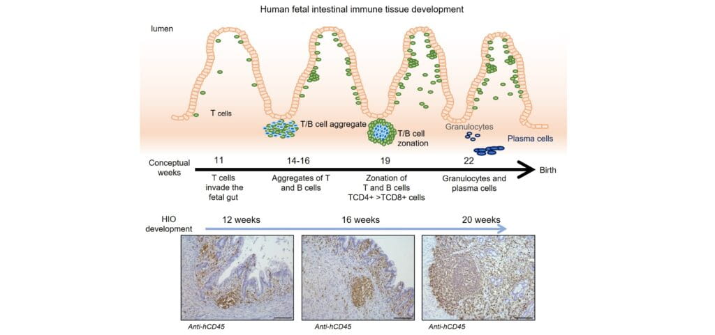 A New First: Creating Organoids with Immune Systems