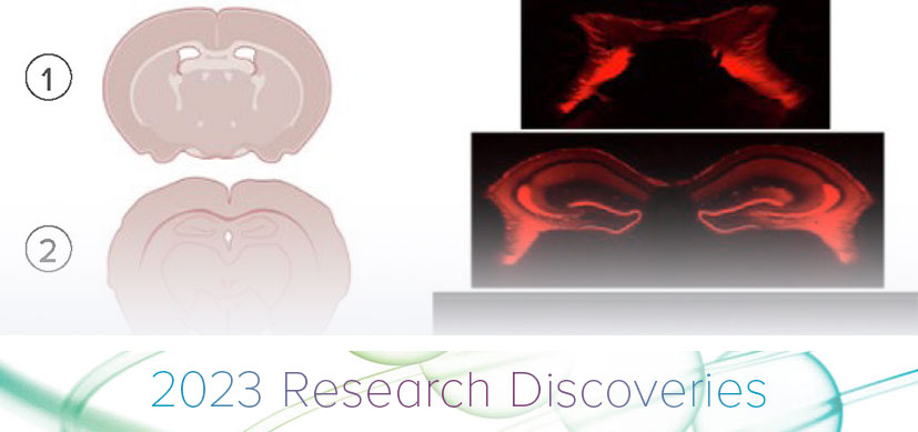 Potential Value of Steroid Treatment for Status Epilepticus May be Sex-Dependent