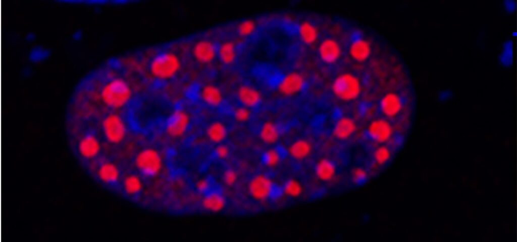 Small Molecule Inhibitors Show Early-Stage Promise Against YAP Fusion-Driven Cancers