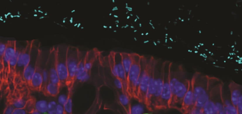 Without a Healthy Immune System, Too Much ‘Good’ Bacteria Can Become a Bad Thing