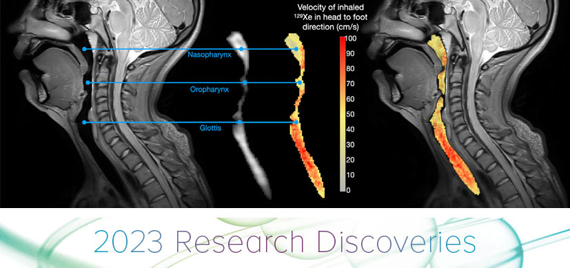 Advancements in Specialized Imaging Create Innovative Airway Assessment Tool