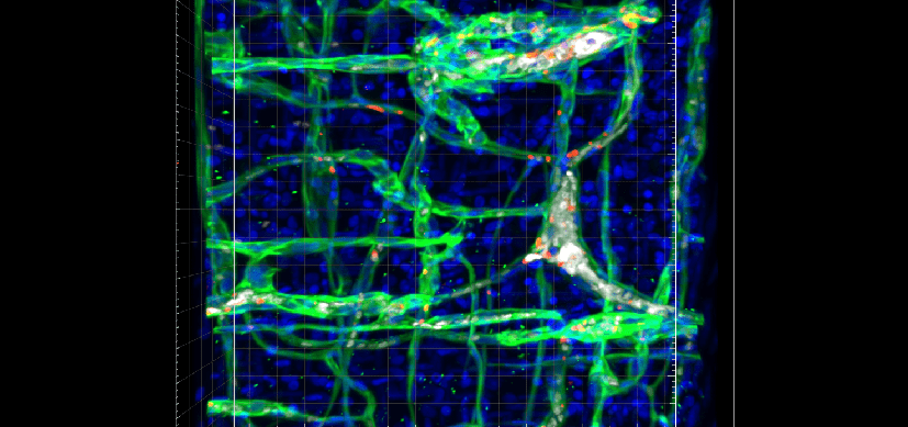 Featured_Image-THUMB.png New Mouse Model Enables Discovery of Potential Treatment for Rare Vascular Tumors—and Beyond