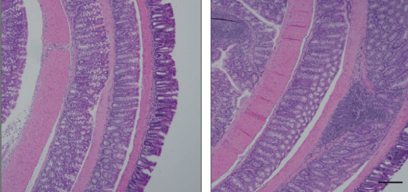Study to Decode Microbe-Gut Signaling Suggests Potential New Treatment For IBD