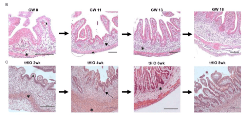 Organoids Validated as Tool for Studying Fetal Intestine Development
