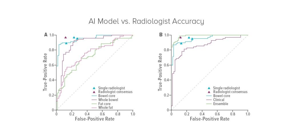 AI Model Outperforms Radiology Experts in Diagnosing Crohn’s Disease in Children