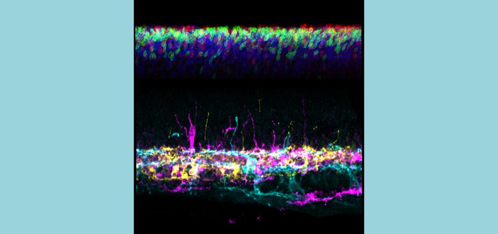 Impact of Lighting on Rod Development in Preterm Mice