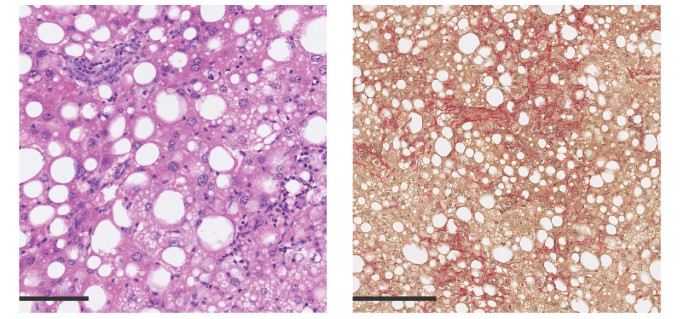 Liver-slides-THUMB.jpg Profiling the Liver’s Frontline Defender