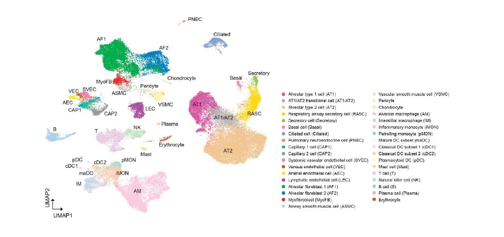 Single-Cell Atlas for ACDMPV Sheds New Light on Lung Development