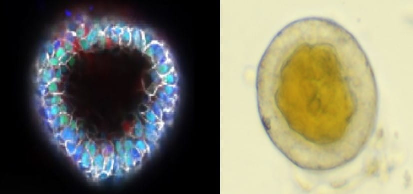 Engineered Organoids Might Serve as Bridge to Liver Transplantation in Severe Jaundice